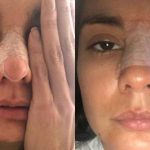 Agresión contra la actriz colombiana Eileen Moreno