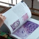 _ El Instituto Nacional de Salud (INS) publicó un informe en donde confirma que en 2019 se presentaron 388 nuevos casos de lepra en el país.