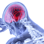 La hipoxia es la falta de oxígeno en los tejidos del cuerpo y es una de las afectaciones en las personas diagnosticadas con covid-19.