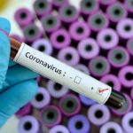 kits reactivos extracción chinos para pruebas de coronavirus