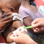 A un niño le miden el contorno del brazo en el Sur de África Foto WORLD VISION/ Europa Press