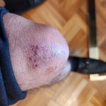 Petro aseguró que sufrió un accidente menor en la casa de huéspedes de Cartagena