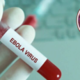 Virus del Ébola