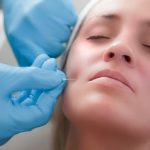 cirugías estéticas