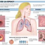 epoc